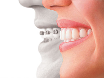 Turley Dental Care | Snoring Appliances, CEREC reg  and Botox reg 